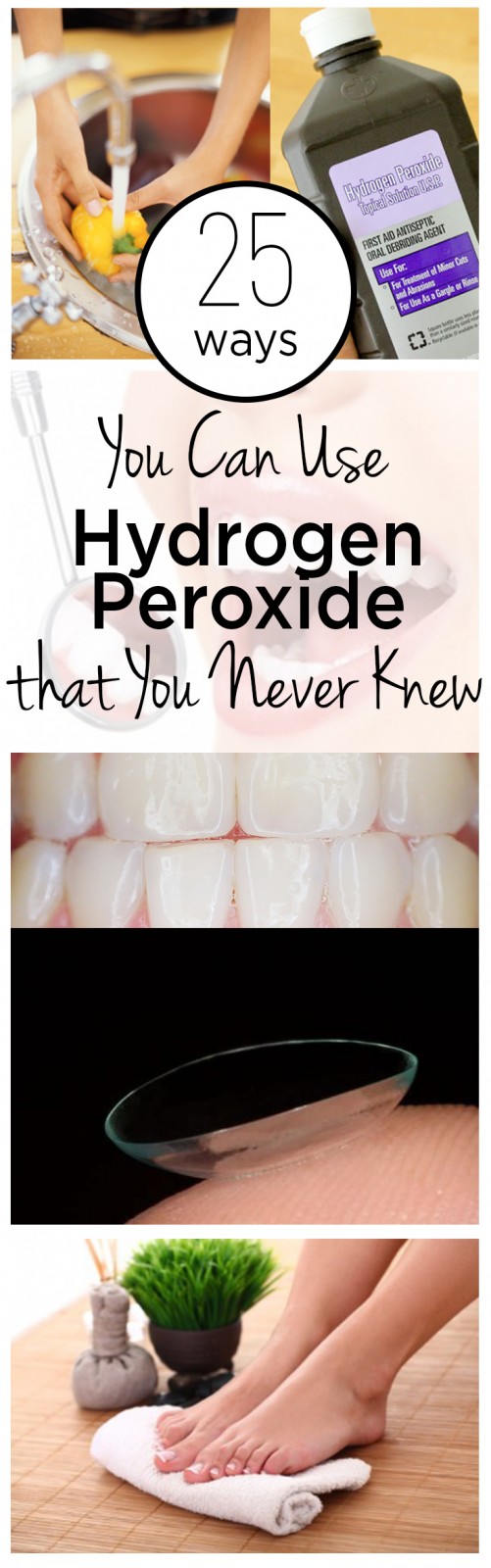 Does Hydrogen Peroxide Help Feet